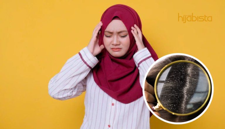 Masalah Kelemumur Makin Teruk? Pakar Dermatologi Saran Elak Lakukan Tiga Perkara Ini