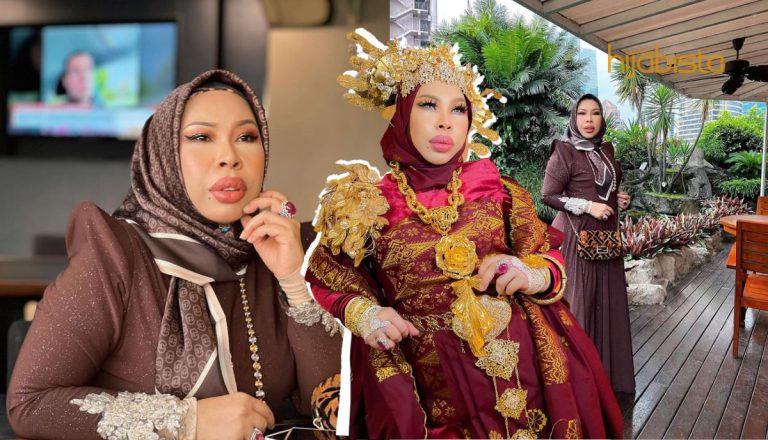 Kurus Tanpa ‘Bariatric Surgery’, Penampilan Terbaharu Vida Buat Netizen terpesona