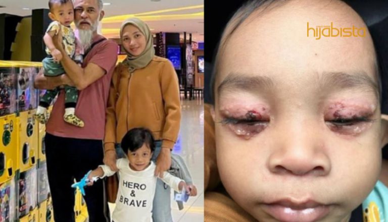 Anak Aman Graseka Perlu Bantuan Pakar Untuk Rawat Mata