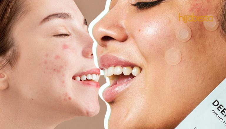 Penampal Hidrokoloid Bantu Sembuhkan Jerawat, Pakar Cadang Guna Semalaman Untuk Hilangkan Noda