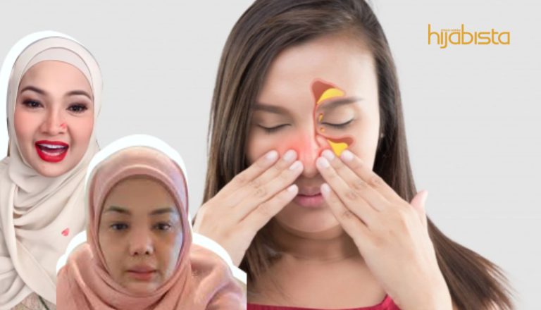 Virus Menyerang Sakit Seluruh Muka Dan Kepala. Fahami Derita Sinus Yang Dihadapi Zarina Zainudin!