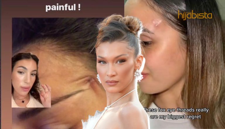 Bedah Mata Ala ‘Fox Eye’ Seperti Bella Hadid, TikToker Ini Dedah Menyesal Lakukannya kerana…