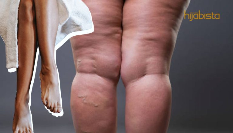 Idam Kaki Sekecil Tiang Lampu, Lakukan 6 Senaman Mudah Ini. Lemak Pun Terhapus!