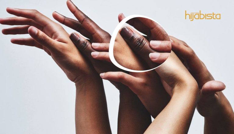 Celah Jari Gelap Dan Berkerak, Solusinya Dengan Dadih Mampu Hapuskan Kulit Mati Dan Cela