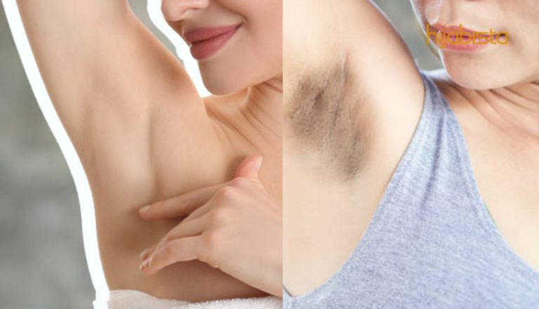 Ketiak Pun Kenalah Cantik! Ini Cara Supaya Ketiak Tak Hitam & Kasar Lepas Cukur