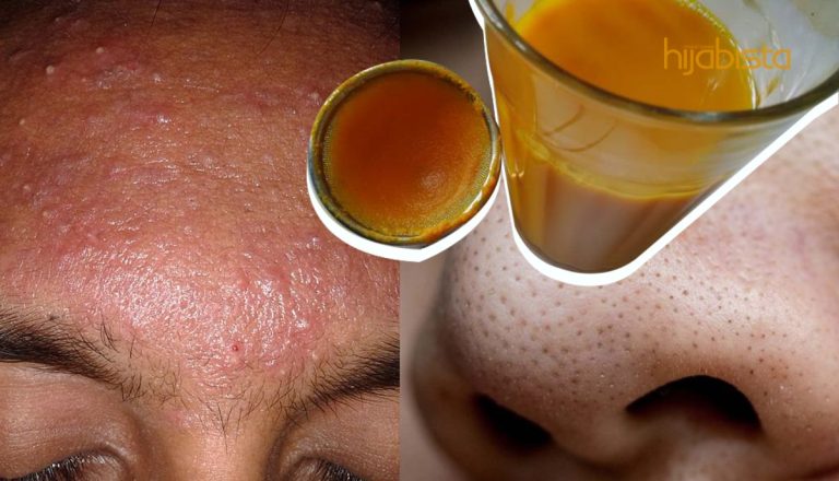 Kembalikan Cahaya Wajah Yang Hilang Dengan 5 Pencuci Muka Kunyit Buatan Sendiri
