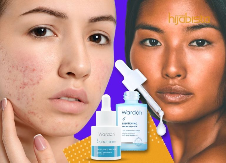 Stress Fikirkan ‘Masalah Kulit’ Makin Teruk? Serum Ini ‘Mampu’ Atasinya! 