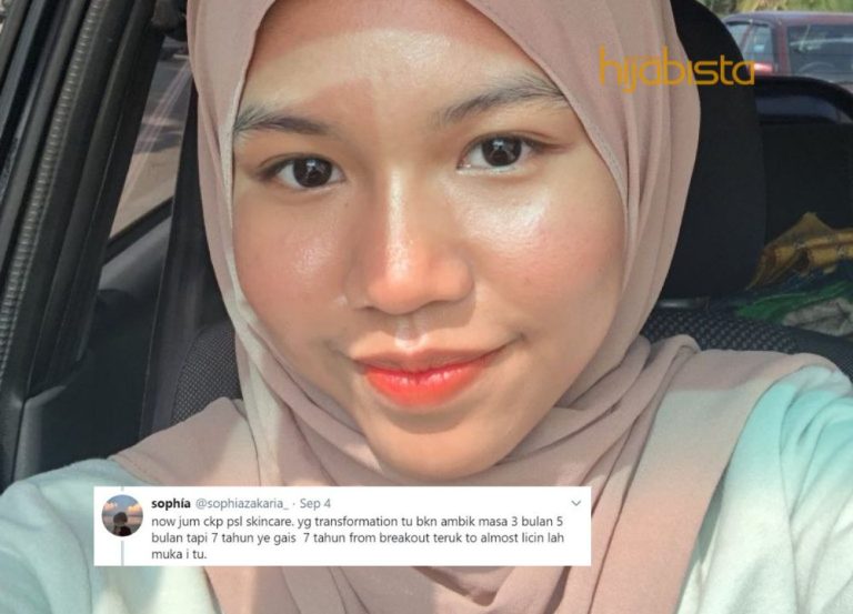 Gadis Ini Dedah Cara Untuk Kulit Flawless & Glowing, Dulu Muka Oily Macam Goreng Ikan