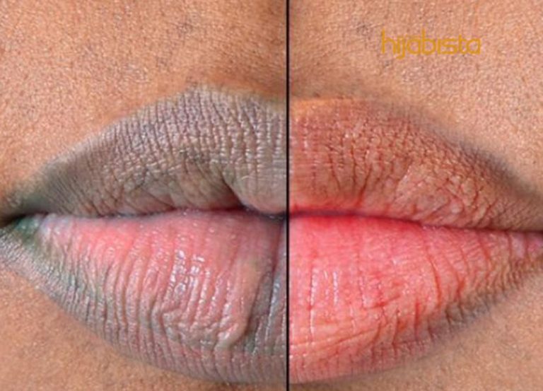 Hebat Betul Bahan Alami. Ini Cara Menghilangkan Bibir Gelap Secara Semulajadi, Merah Jambu Serta-merta!