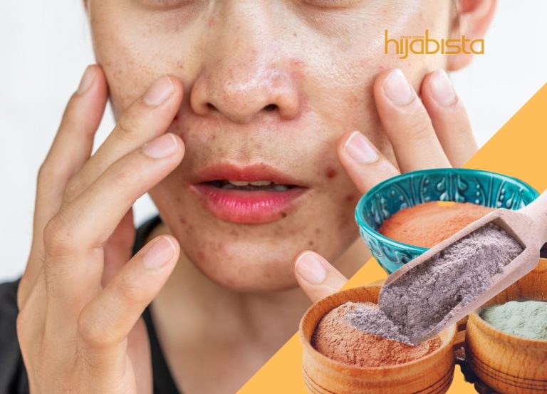 Muka Berminyak Sampai Jerawat Beranak Pinak? Tepek Je ‘Masker’ Ni Sis