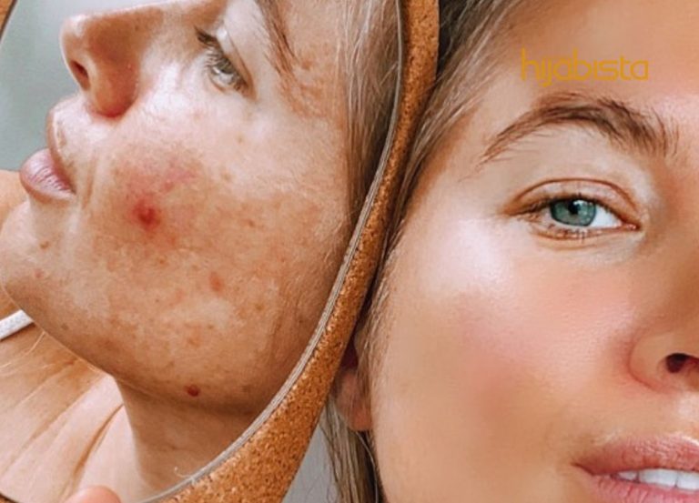 Ucap Selamat Tinggal ‘Filter’, Jom Rawat Kulit Dengan 3 Cara Mudah Ni!