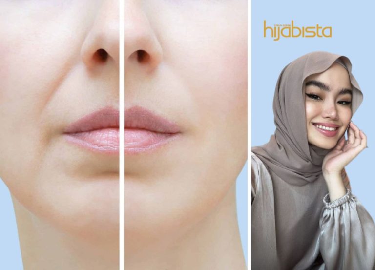 3 Cara Ini Boleh Menghilangkan ‘Smile Line’ Anda, Tanpa Sebarang Kos Pembedahan!