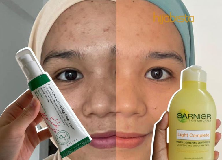 Lepas 2 Bulan Pakai Produk Ni Muka Kusam Kembali Bercahaya. Selfie Tak Perlu Filter Dah!