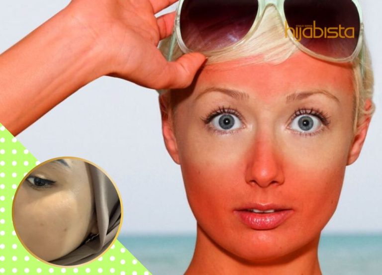 Cuaca Terlampau Panas, Buat Kulit Hijabi ‘Berbelang’ Hingga Tona Tak Sekata? Ini Penyelesaianya!