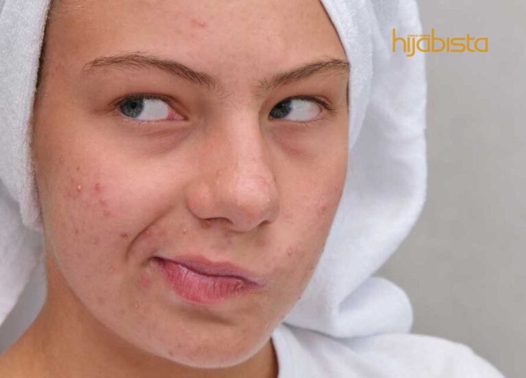 ‘Nyahkan’ Masalah Kulit! Kembalikan Seri Wajah Dengan Pakar Serum