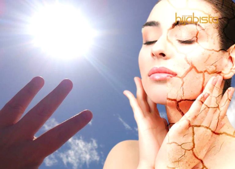 Ouch! Sakitnya Kulit Kering Menggelupas Di Musim El-Nino, Jom Lembapkan Kulit Dengan Cara Ini Sis