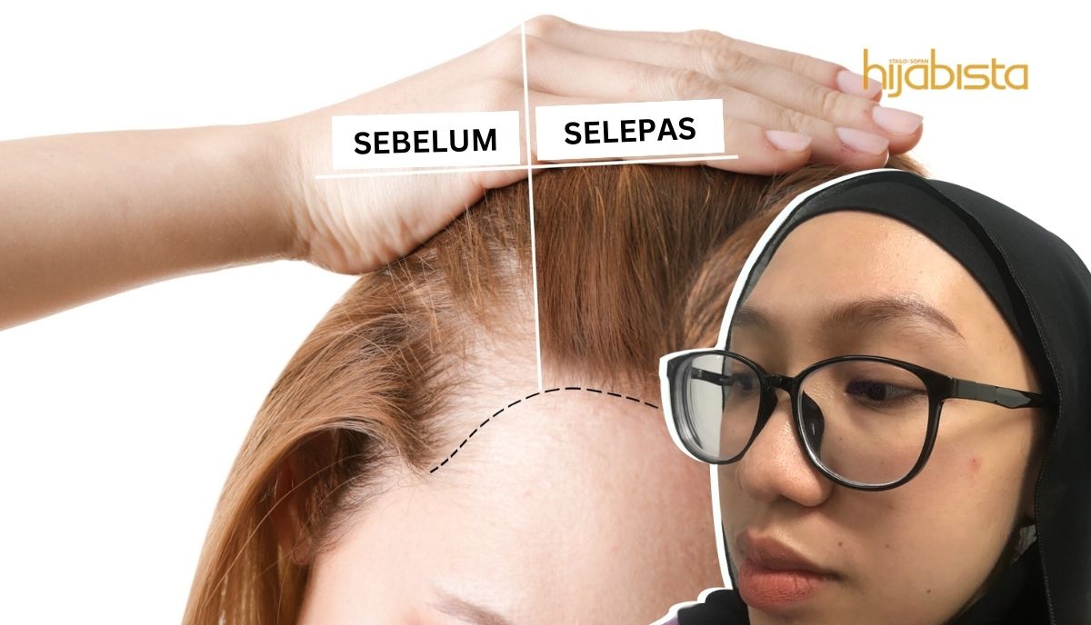 Cara Membentuk Dahi Secara Semulajadi Tanpa Mencabut