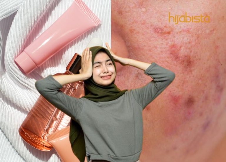 5 Kebiasaan Yang Menyebabkan ‘Skin Barrier’ Jadi Rosak! Wajib Tahu!