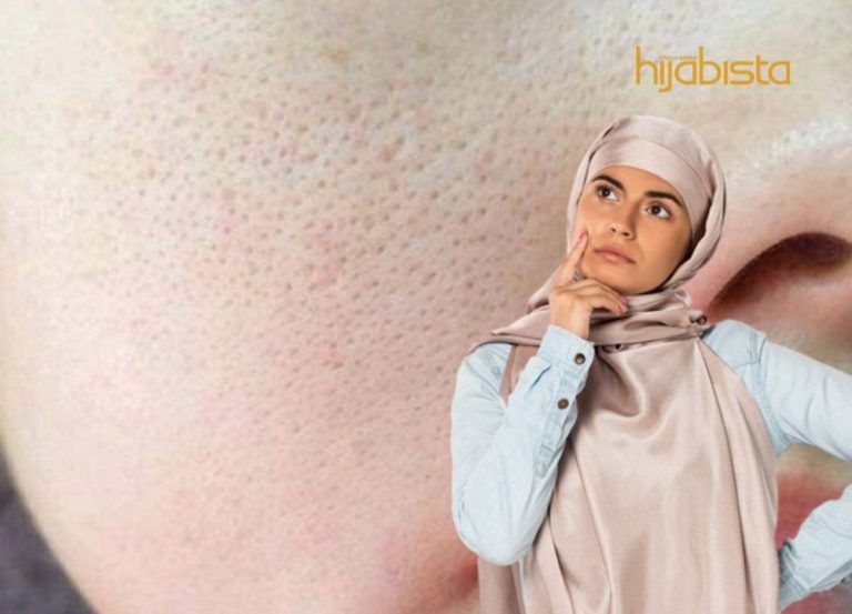 Cara Berkesan Untuk Mengecilkan Pori-Pori Di Muka, Cubalah!
