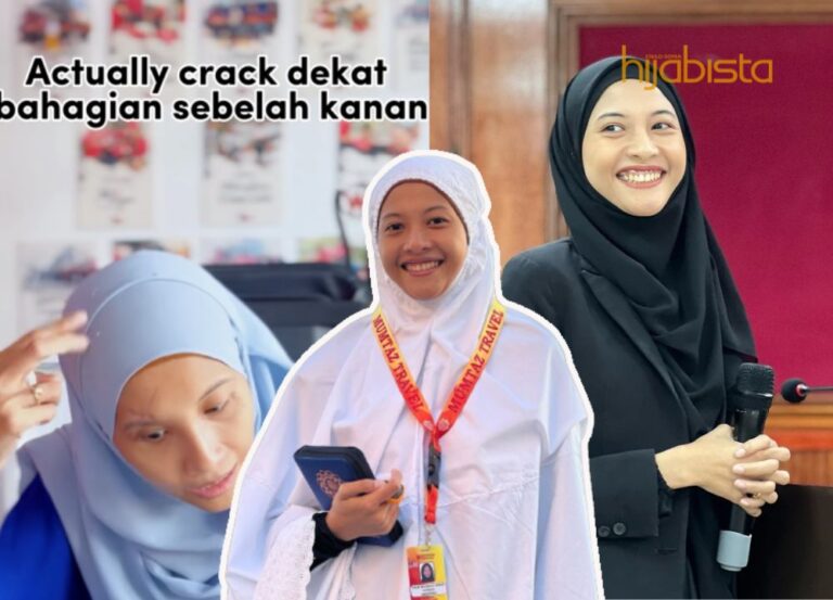 Meski Allah Tarik Nikmat Mata Selepas Kemalangan, Hijabi Ini Kekal Positif! – “Saya Tak Anggap Ujian Ini Satu Bala”