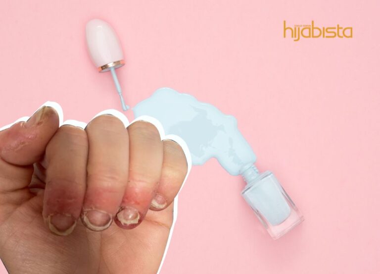 Wanita Ini Gagal Gerakkan Tangan Selepas Bertahun-Tahun Memakai Pengilat Kuku…