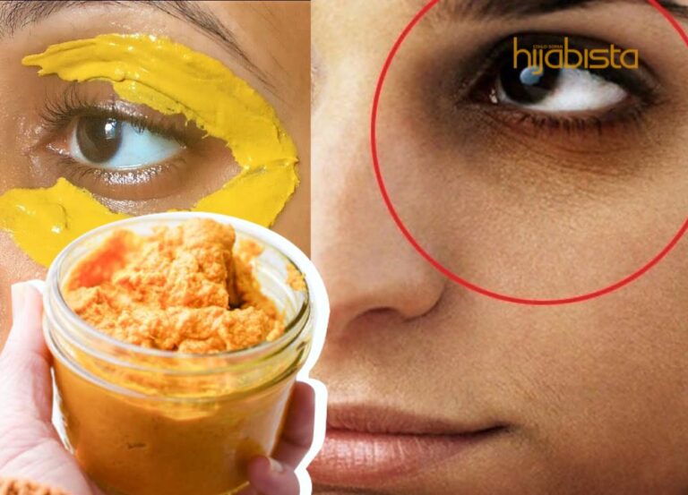 Hapuskan Lingkaran Hitam Bawah Mata, Sapukan Pes Kunyit Jer. Hasilnya Mengagumkan!