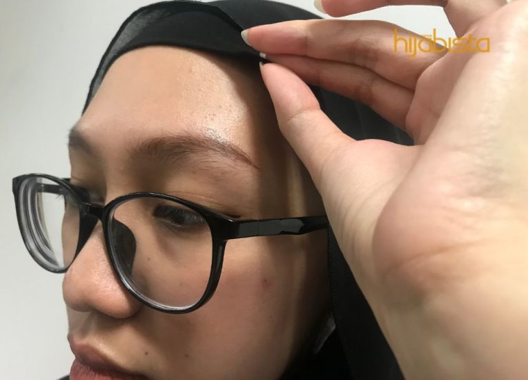 Selalu Ulang Pakai Anak Tudung Yang Sama, Punca Jerawat Tumbuh Di Dahi. Ini Rawatan Sewajarnya!!