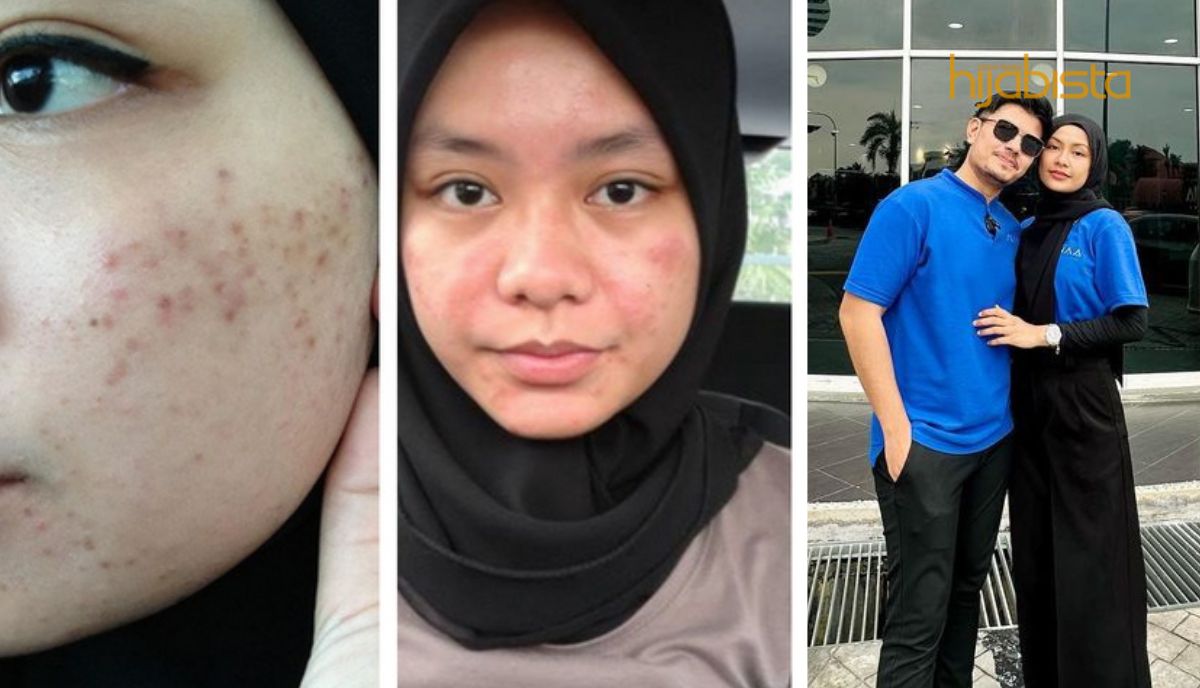 Syafiqah Aina Pernah Cecah Berat 63KG, Suamilah Mentor Untuk Berdiet Dan Kekal Cantik – Hijabista
