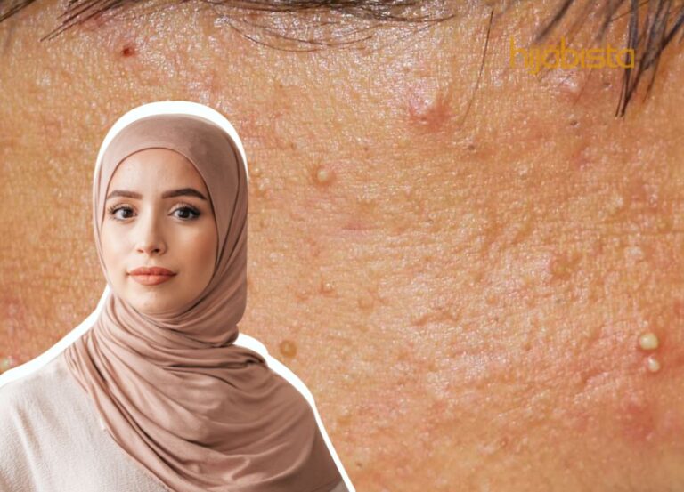 Punca Benjolan Di Muka Yang Anda Tidak Sedari, Pakar Cadang Rawatan Terbaik