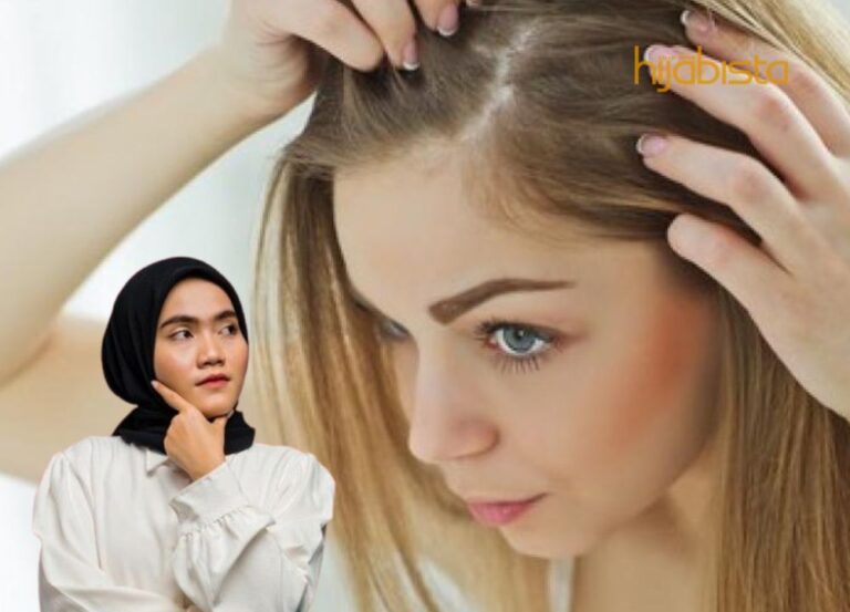 Jerawat Di Kepala, Cara Berkesan Mengatasinya!