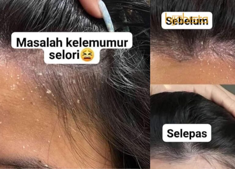 Sekali Pakai Lesap Semua Kelemumur, Hijabi Ini Kongsi Syampu Paling Berkesan