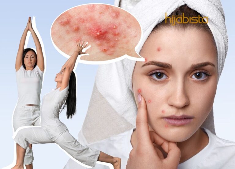 Selain ‘Skincare’, 5 Senaman Ini Juga Bantu Hijabi Atasi Masalah Jerawat. Tak Perlu Keluarkan Kos!