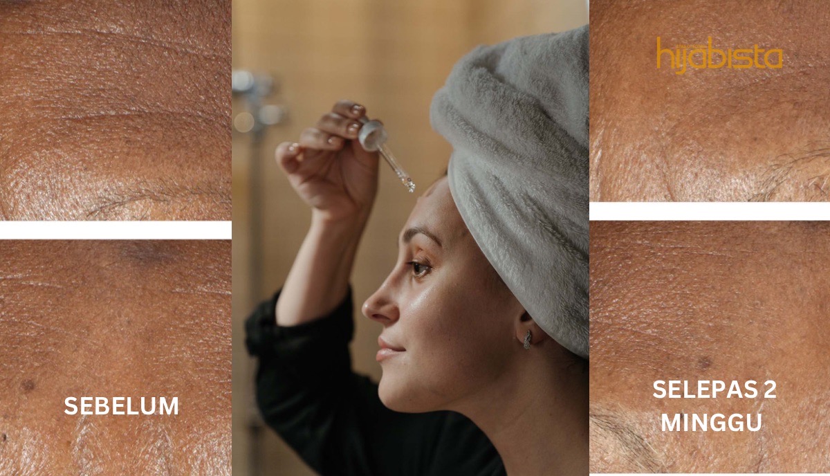 8 Kesilapan Yang Perlu Dielakkan Apabila Menggunakan Retinol, Pada Awalnya Memang Merengsakan, Lihat Sahaja Hasilnya..