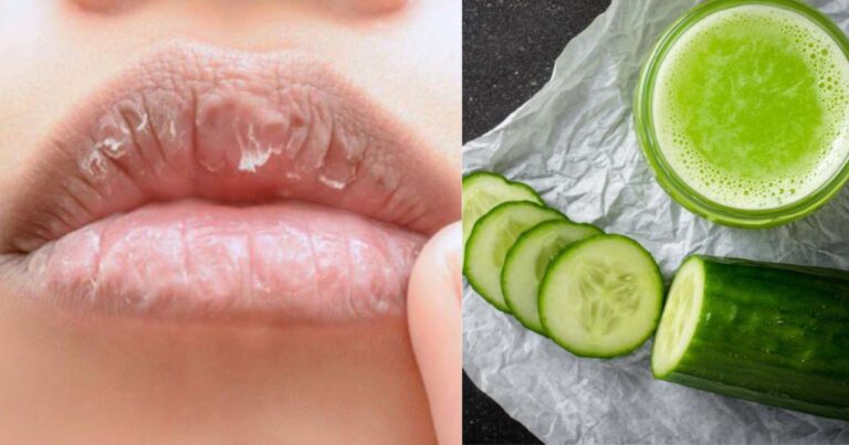 Bibir Gelap Kembali Cerah, Amalkan 5 Petua Mudah Ini Setiap Hari