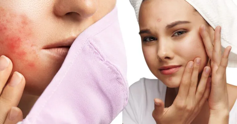 Rahsia Detoks Wajah Paling Berkesan, Inilah Ciri-Cirinya Untuk Kulit Glowing!