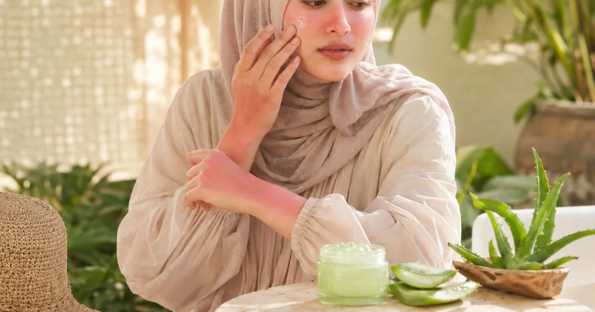 Muka Merah & Pedih Lepas Berpanas? 8 Tip Ini Untuk Redakan Sunburn
