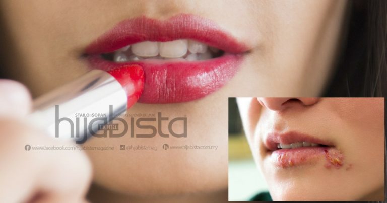 Wanita Ini SAMAN Jenama Kosmetik ANTARABANGSA Akibat Derita Dijangkiti ‘HERPES ORAL’, Lepas Cuba SAMPEL Lipstik