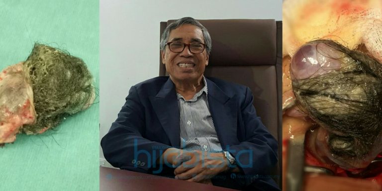 Dr. Hamid Arshat Kongsi 10 Cara Jaga Pemakanan Selepas Jalani Pembedahan Dermoid Cyst