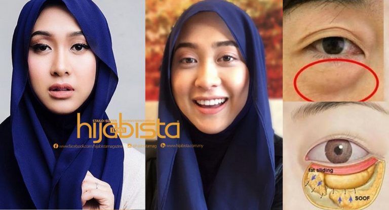 10 Cara Atasi Masalah Kantong Mata Atau Eye Bag Tanpa Solekan Tebal. #10 Berkesan Sekiranya Kecemasan.