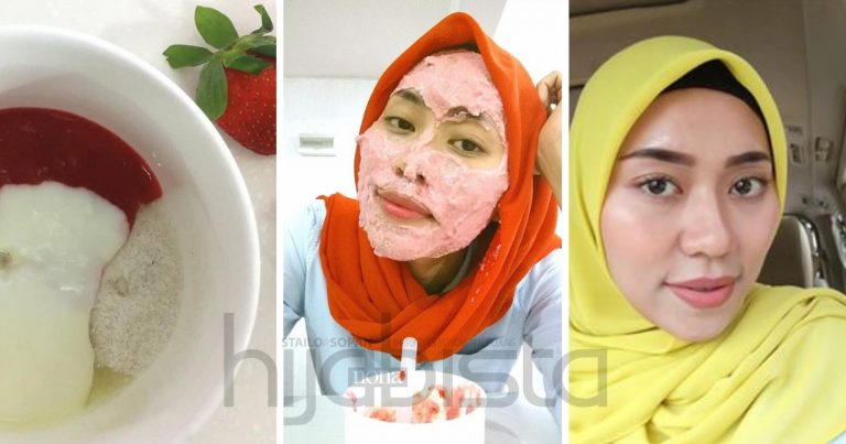 Wanita Ini Kongsi Cara Mudah Hilangkan White Head & Black Head, Syaratnya Kena Konsisten