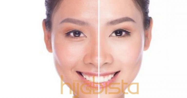 Nak Kulit Putih Gebu Secara Semulajadi, Ikuti 5 Petua Mudah Ini