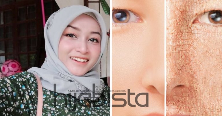 Kulit Kering Punca Mekap Tak ‘Glowing’, Ikuti Cara Gadis Ini Untuk Merawatnya