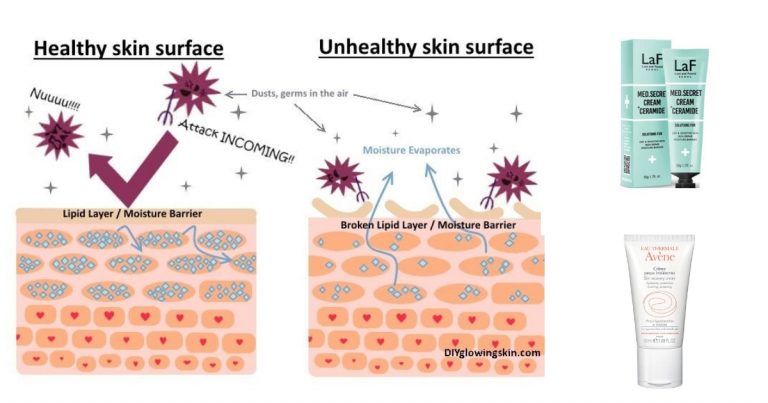 Wanita Ini Kongsi Sebab Utama Masalah Wajah & Jadikan Kulit Selicin Sutera Guna Produk Bersesuian