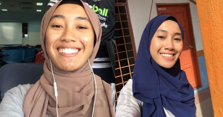 Lepas Try & Error Setahun, Akhirnya Gadis Ini Pulih Dari Masalah Kulit. Tak Lokek Kongsi Rutin Penjagaannya!