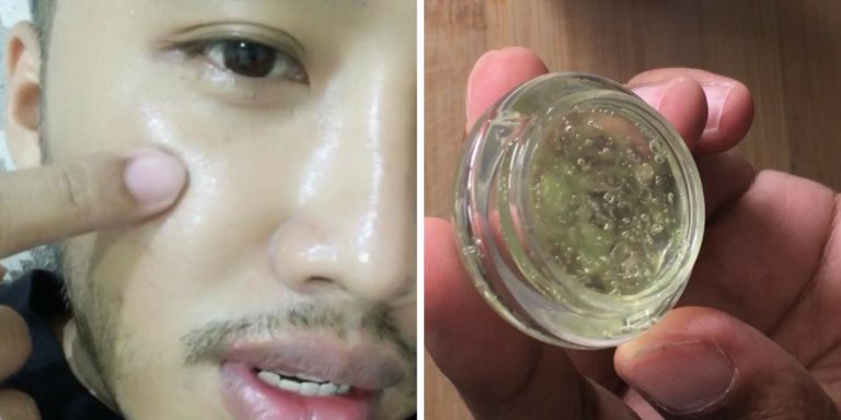 Rahsia Kulit Jadi Flawless Bak Putih Telur, Perkongsian Lelaki Ini Dikongsi Hampir 25k Netizen