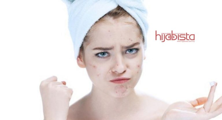 Banyak Jerawat Tanda Kita Banyak Penyakit Dalaman. No. 3 Paling Ditakuti.