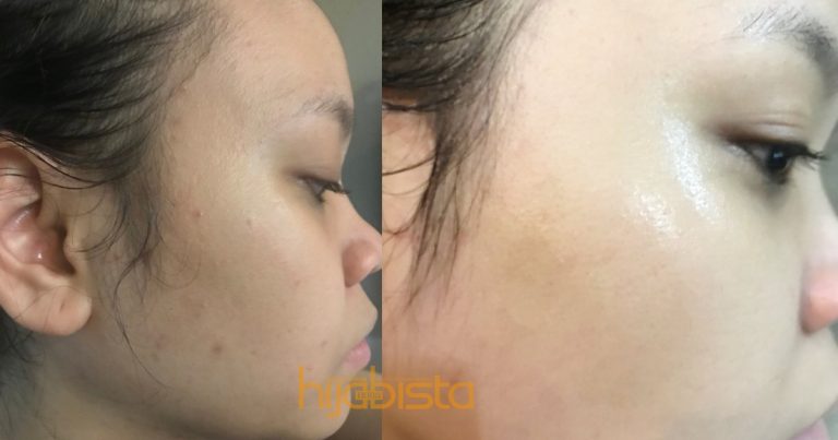 Gadis Ini Berjaya Dapatkan ‘Glass Skin’ Hanya Dalam Masa Sebulan. Ini Rahsianya!