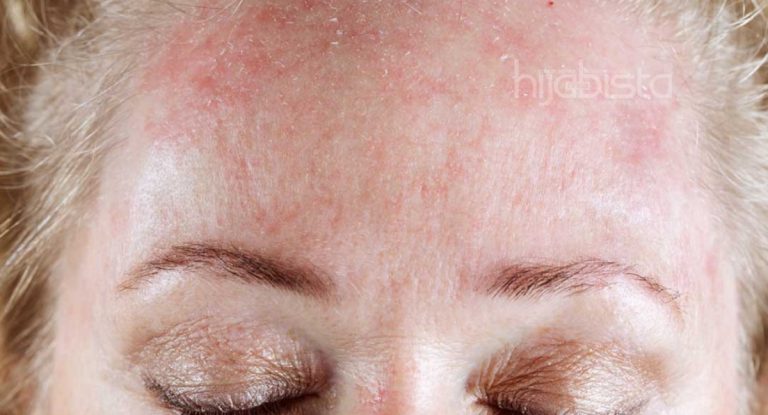 Sekiranya Muka Alami 9 Tanda-tanda Ini, Maknanya Produk Muka Tersebut Tak Sesuai Untuk Anda. Hati-hati sis!