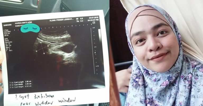 “Kalau Sayangkan Rahim Tolong Elak 8 Perkara Ni,” Pesan Wanita Ini Yang Pernah Kena Cyst Berulang Kali