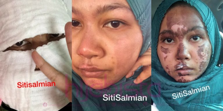 Gara-Gara SUP TULANG, MUKA Wanita Ini Habis MELECUR. Dugaan Sebulan Sebelum KAHWIN!